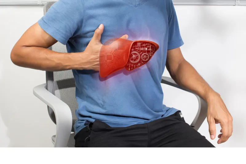 Metabolic dysfunction-associated steatotic liver disease (MASLD)