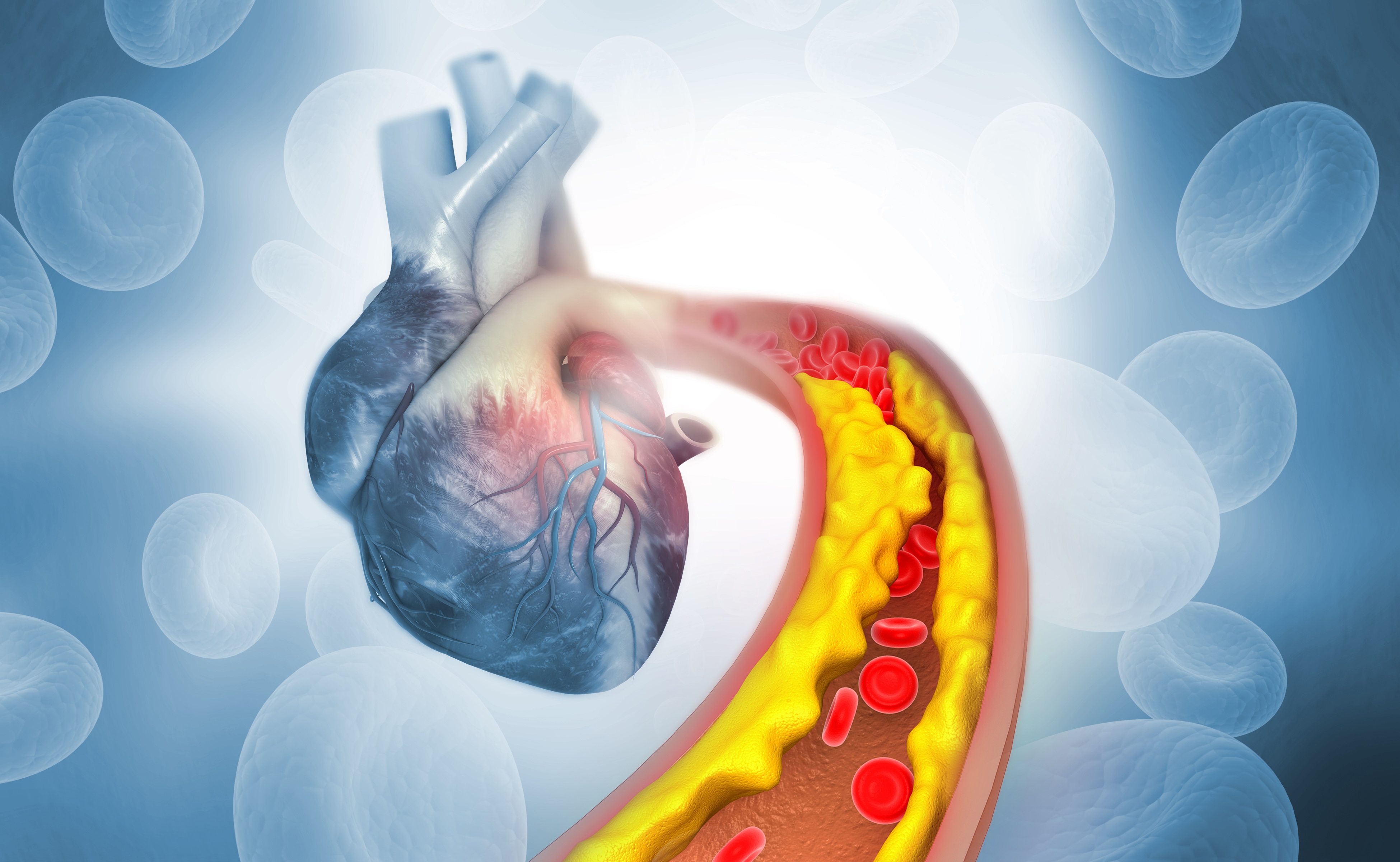 Diabetes and Cholesterol