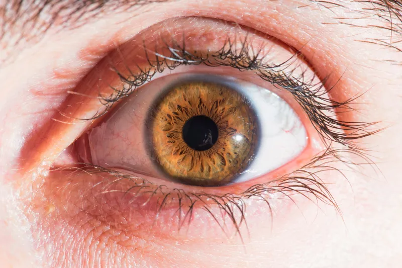 Bengali -Your guide to diabetic retinopathy