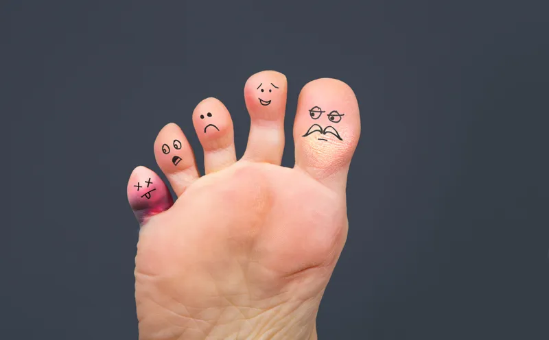 Bengali - Looking after your diabetic foot ulcer