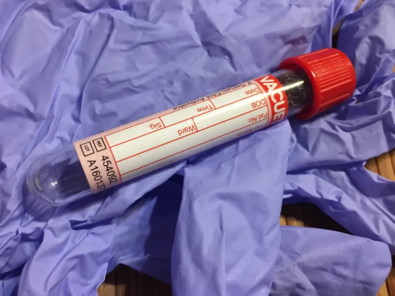 HbA1c and Time in Range Explained