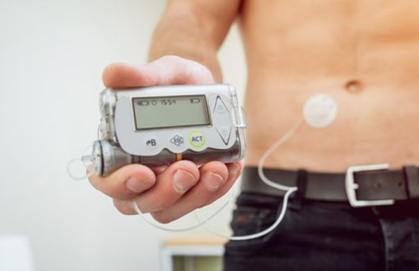 Image for Insulin Pumps
