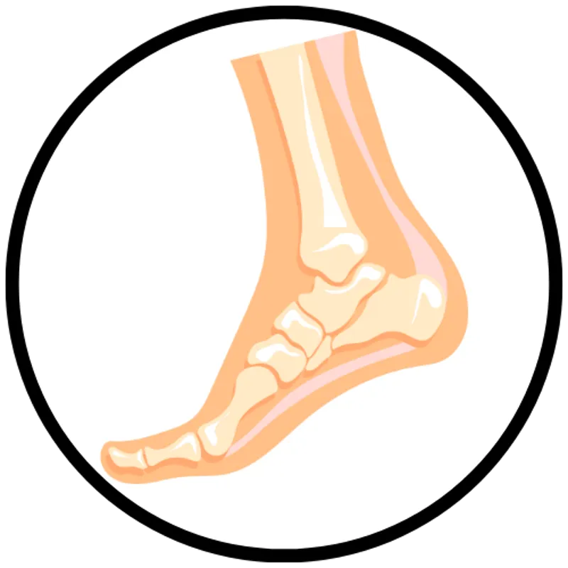 What is Charcot foot?