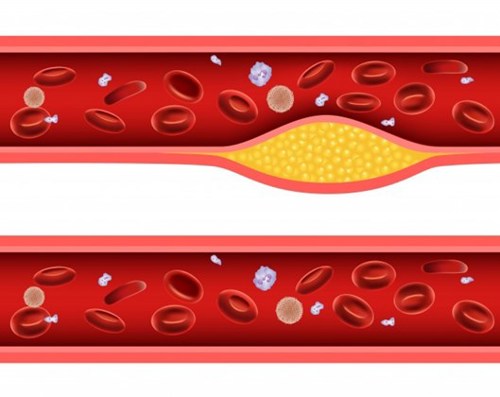 cholesterol.jpg