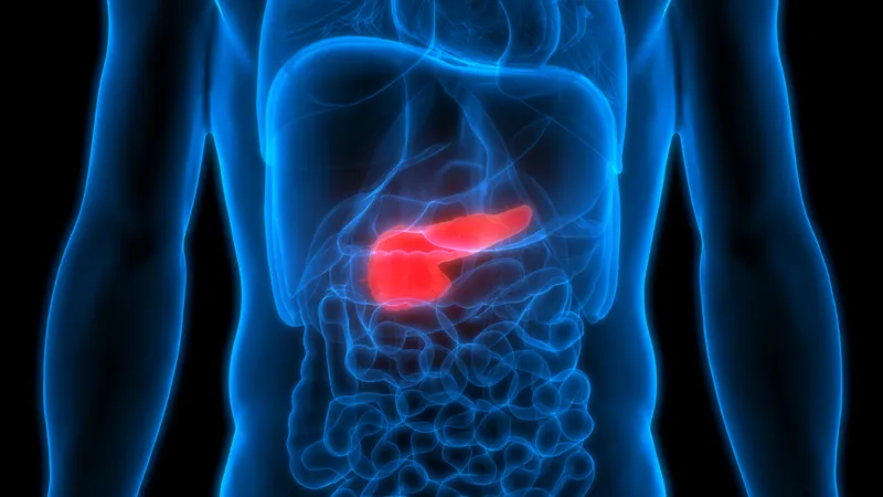 What is type 3c diabetes?