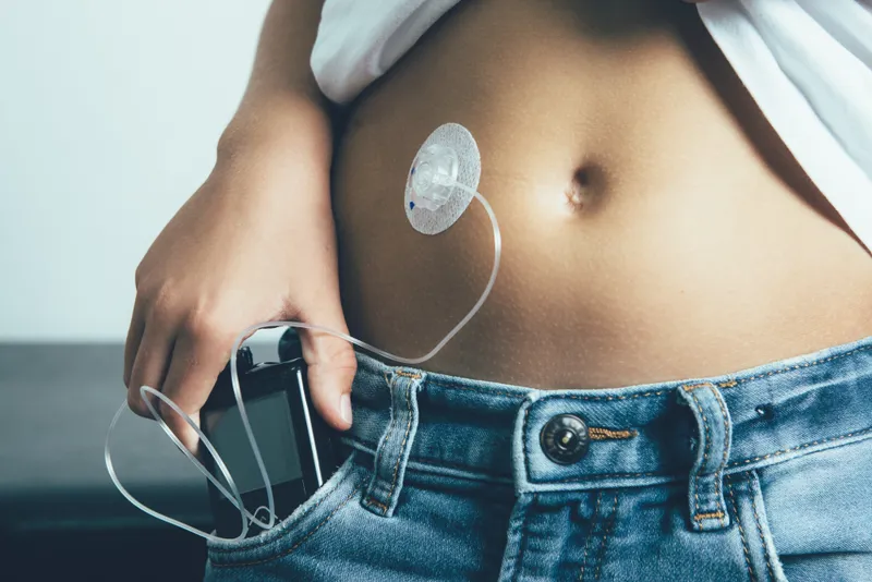 Insulin Pumps