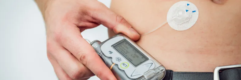 Insulin Pumps