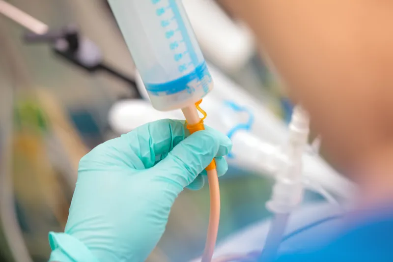 Diabetes and Enteral Feeding
