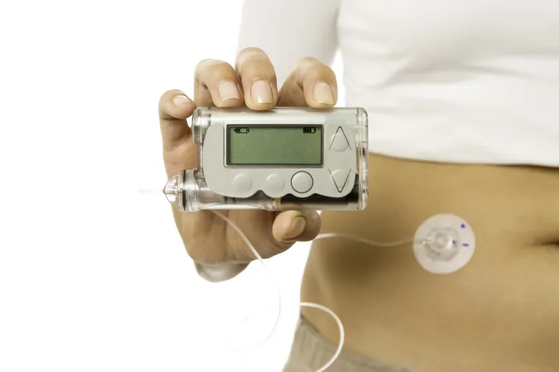 Patient experience - using an insulin pump